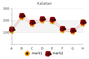 buy 2.5 ml xalatan free shipping