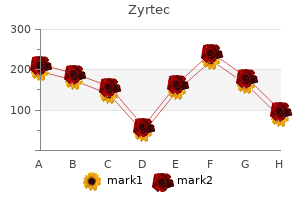 order generic zyrtec