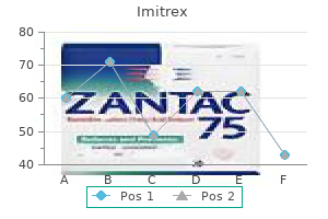 discount 50 mg imitrex otc