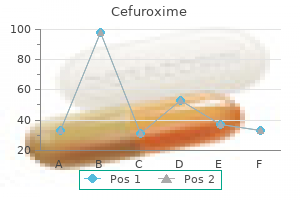 order cefuroxime 250mg free shipping