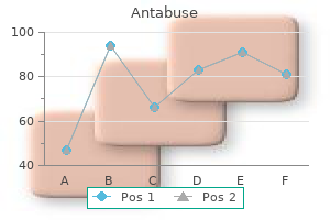 antabuse 250 mg for sale